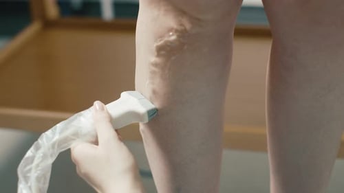 Close up of person using vein surgery scan device