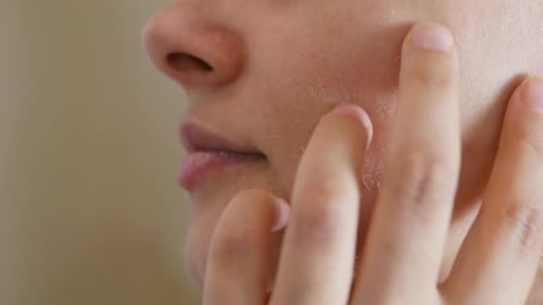 Close Up Capturing Woman Gently Touching Dry Irritated Facial Skin Highlighting Sensitive
