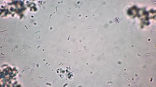 Many Small Bifid Bacterium Are Moving in Fermented Dairy Product in Magnification
